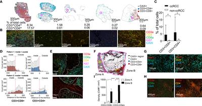 Integrated TCR repertoire analysis and single-cell transcriptomic profiling of tumor-infiltrating T cells in renal cell carcinoma identifies shared and tumor-restricted expanded clones with unique phenotypes